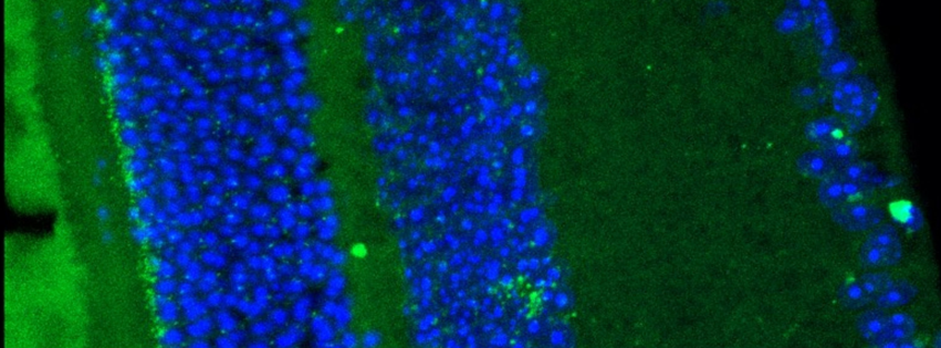 fluorescence microscopy image of mouse retina